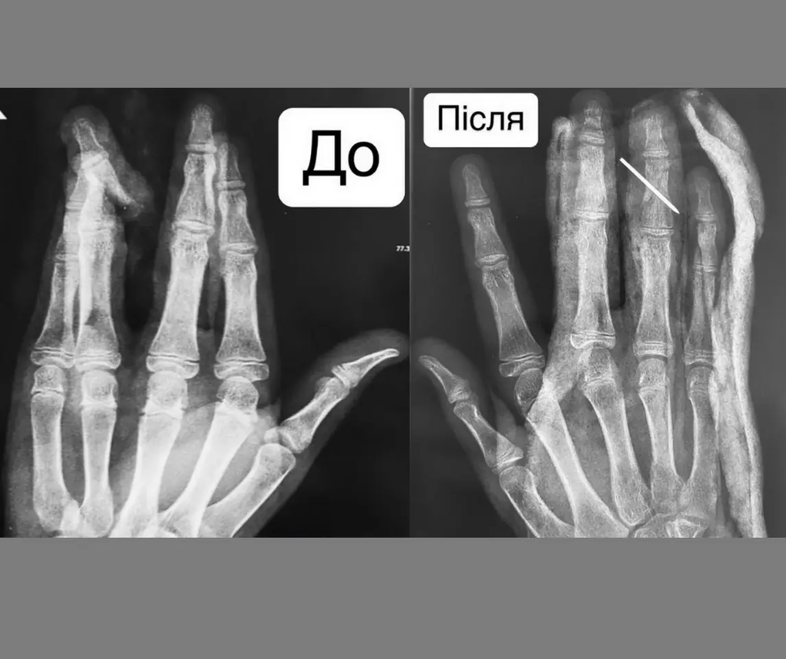 Зображення