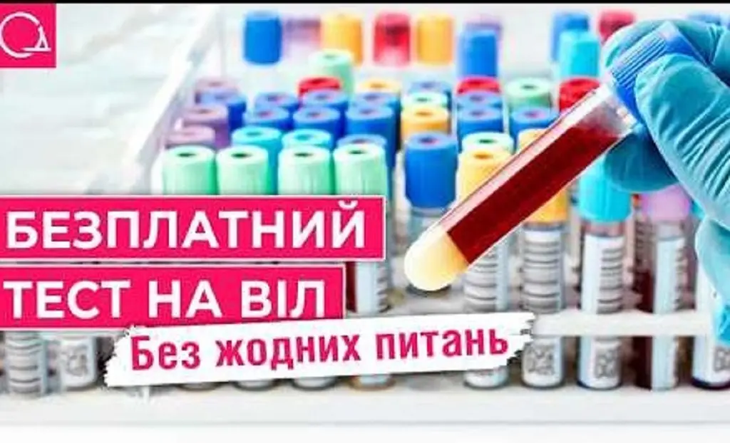 Не бійся знати: де в Одесі пройти тест на ВІЛ швидко й безоплатно (відео)