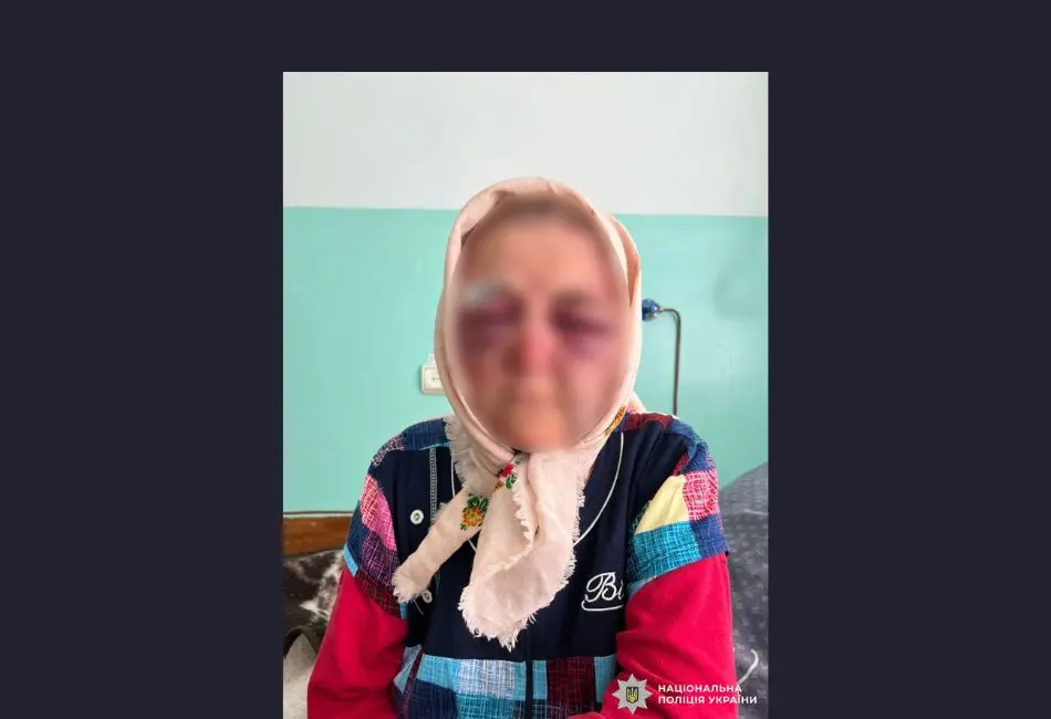 На Вінниччині чоловік побив пенсіонерку та відібрав у неї 18 тисяч гривень