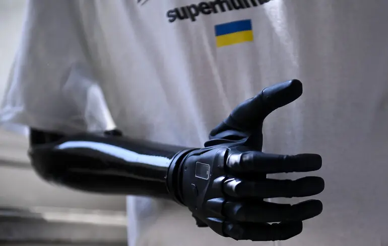 Від милиць та ходунків до персональних асистентів: які види соцдопомоги доступні тим, хто повернувся з полону