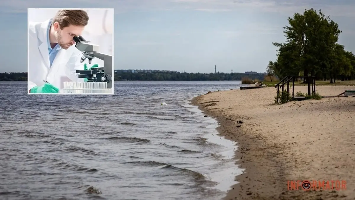У Дніпрі та Підгородньому у воді на пляжах виявили холероподібний вібріон: чим він небезпечний