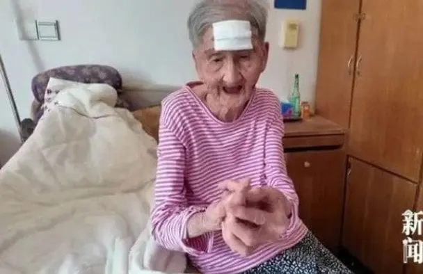 98-річна бабуся відрізала ножицями "ріг довголіття" на чолі — фото