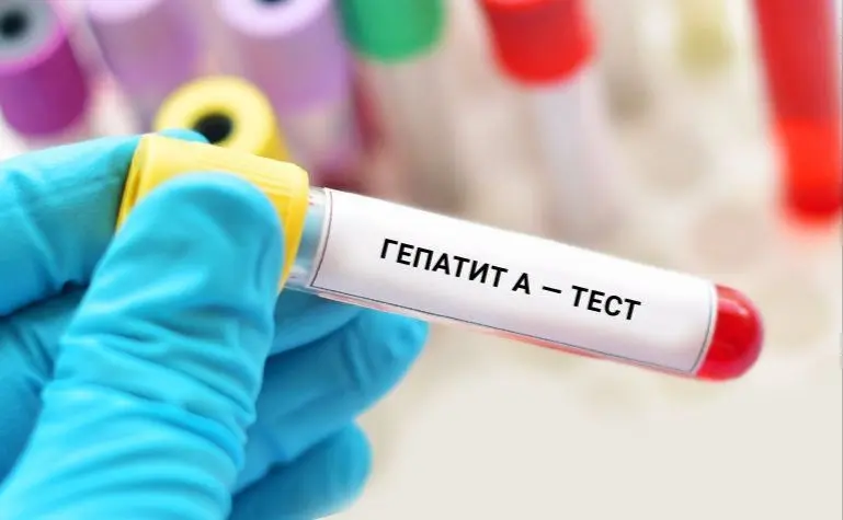 26 липня у київському парку Шевченка безкоштовно тестуватимуть на гепатити В та С