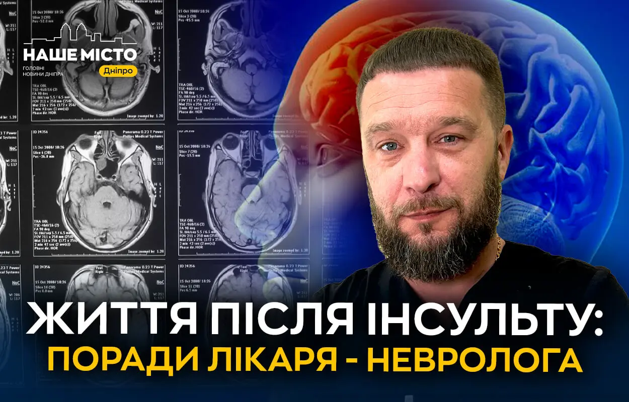 Життя після інсульту: історія дніпрянина, який після складної операції відновлюється завдяки щоденній реабілітації