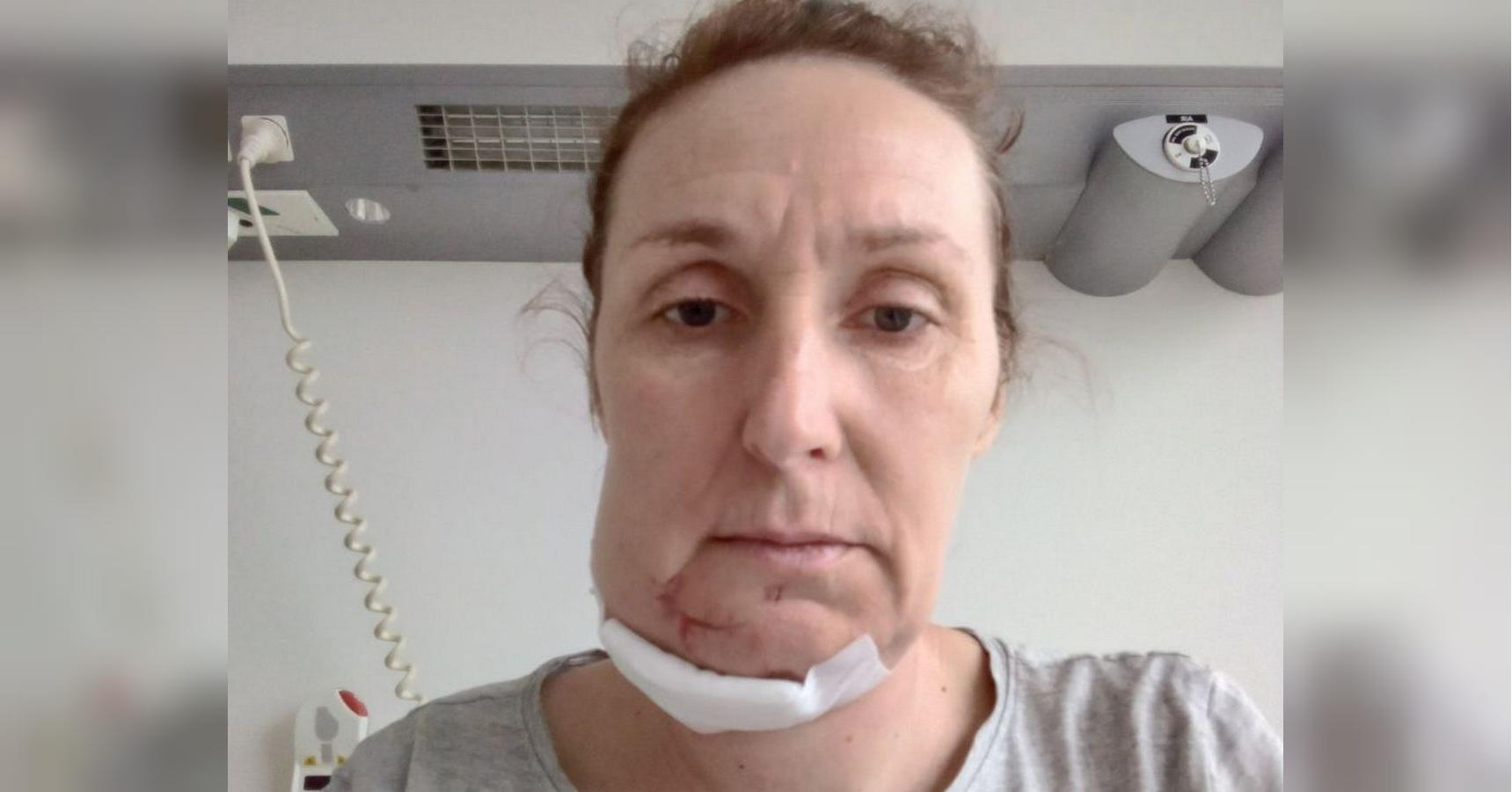 «Відчула, що в роті повно вибитих кулею зубів. Не зупиняючи машину, виплюнула їх в руку й викинула у вікно»: поранена жінка врятувала дітей від окупантів