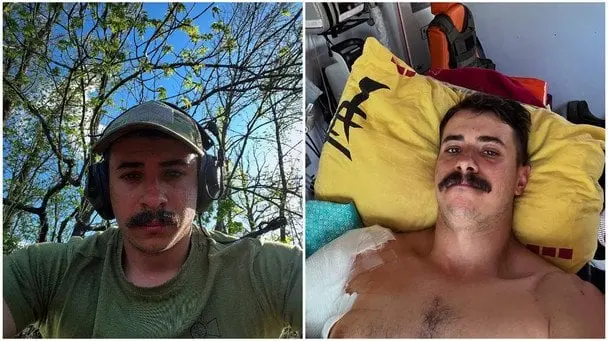 Син Костянтина Грубича після ампутації руки вийшов на зв'язок з важливим проханням