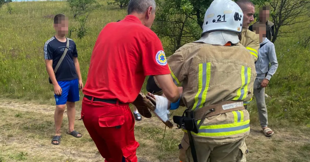 На Вінниччині 14-річний хлопчик наступив на дошку, густо забиту цвяхами