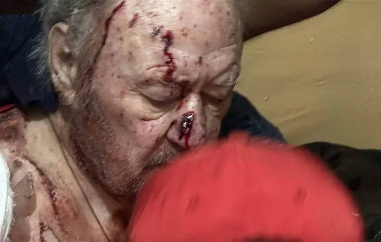 Під час масованої атаки дронів Одеса зазнала значних руйнувань: мерія показала, яких саме