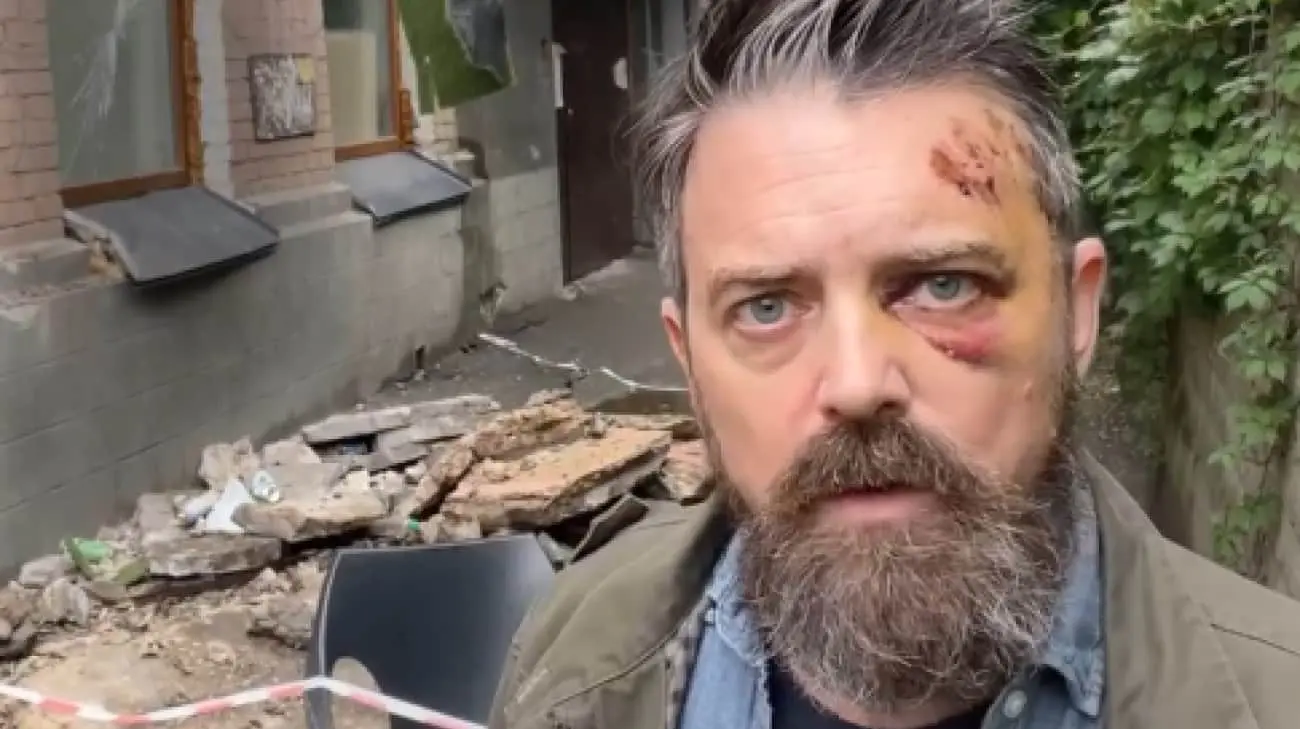 Під американським журналістом в Києві обвалився балкон