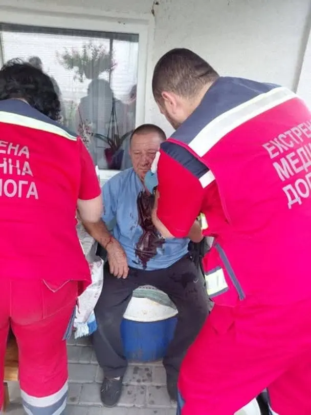 На Київщині жорстоко побили батька полеглого воїна: реакція поліції