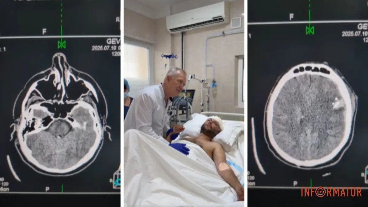 Лікарі зробили неможливе: у Дніпрі медики врятували чоловіка, який отримав важке поранення у голову