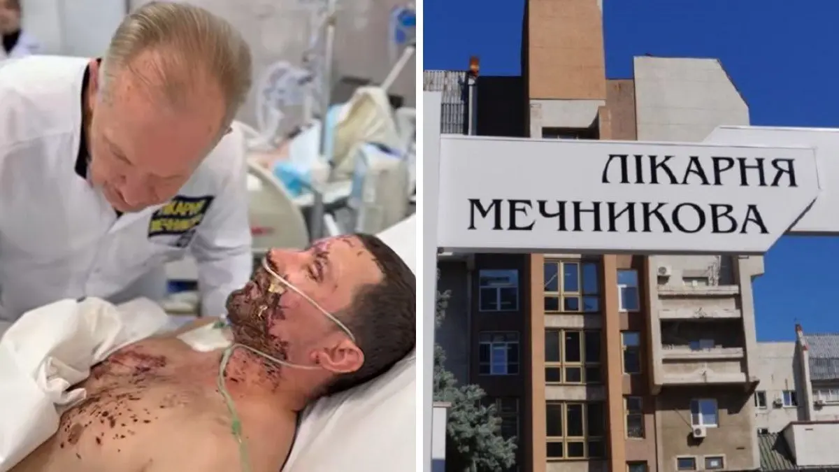 Висока ампутація ноги та вражені очі: у Дніпрі рятують 34-річного чоловіка, який підірвався на міні